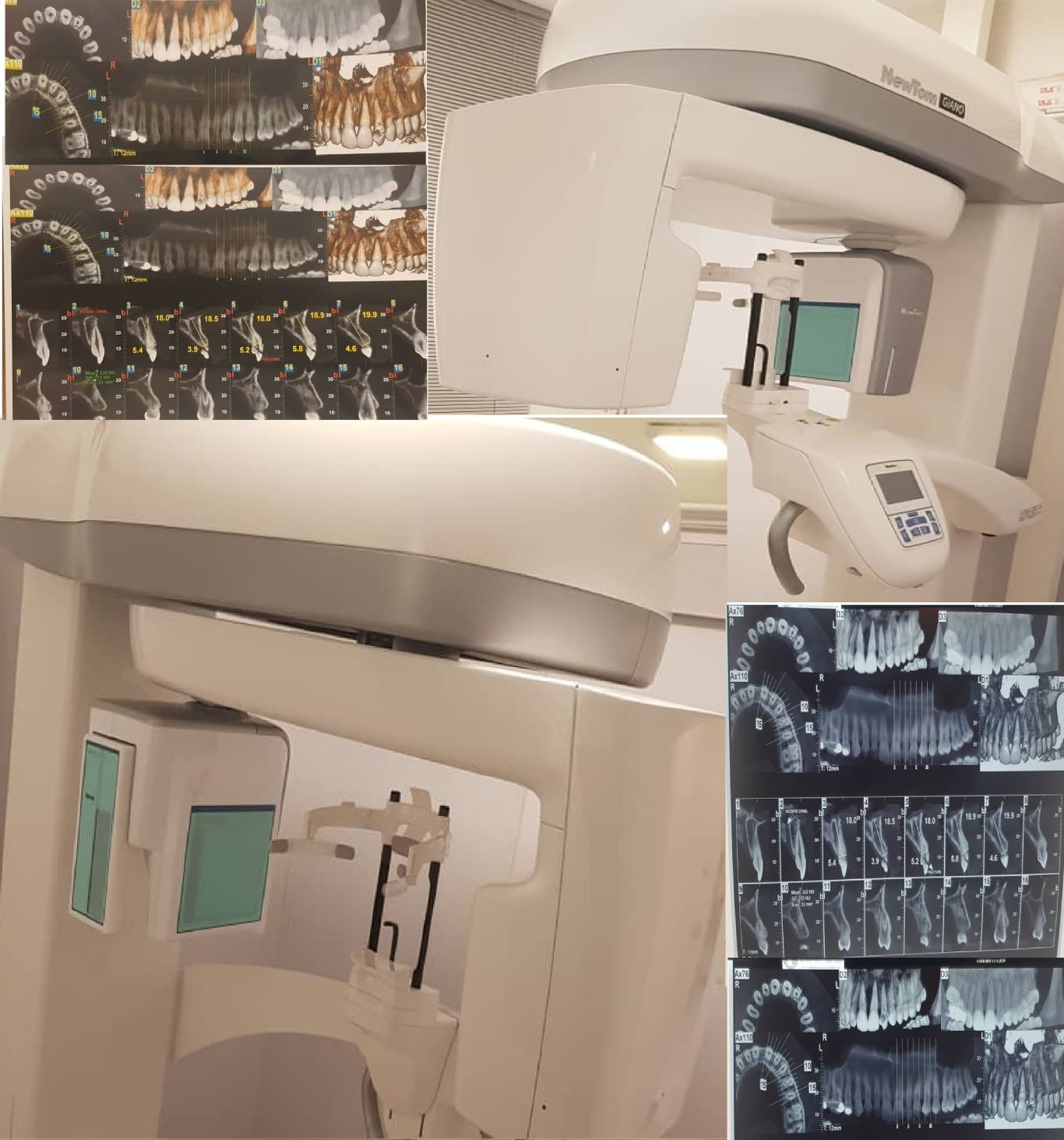 CBCT